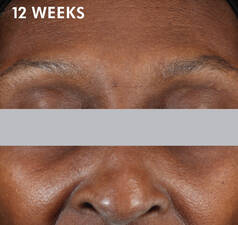 A.G.E. INTERRUPTER ADVANCED