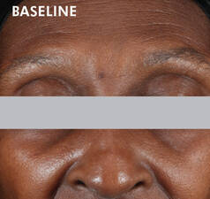 A.G.E. INTERRUPTER ADVANCED