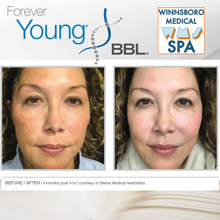 Forever Young Club – Luxury Skin Membership