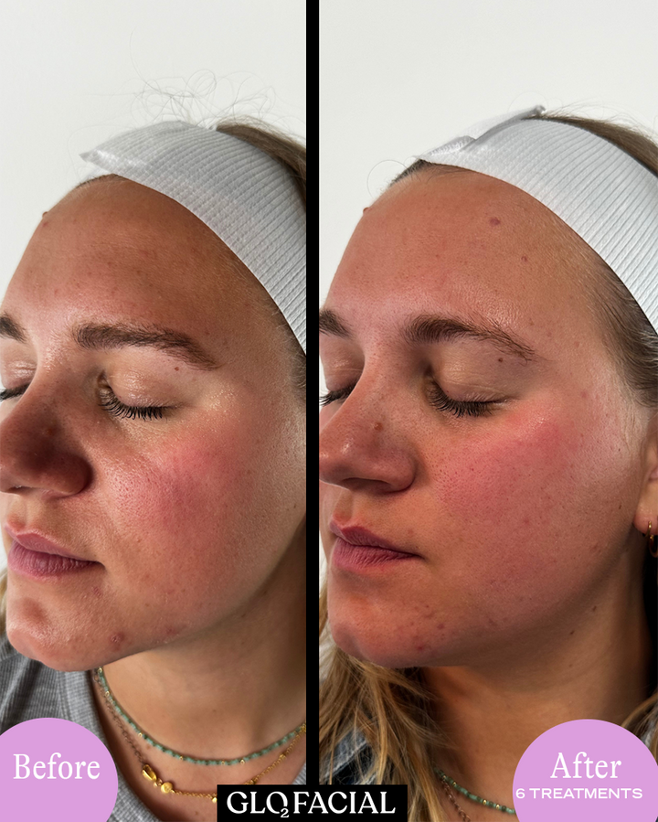 Forever Young Club – Luxury Skin Membership