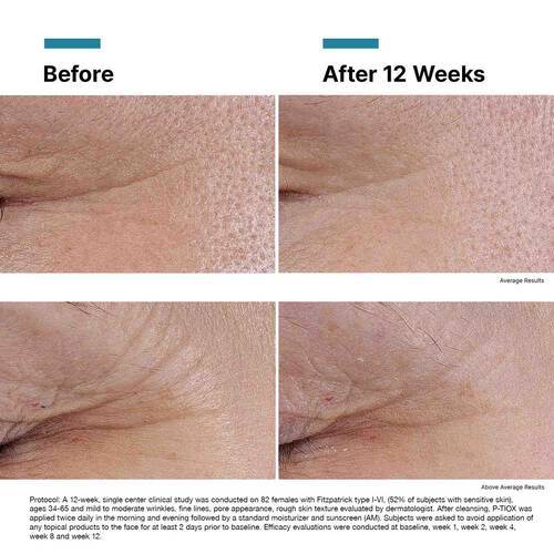 SkinCeuticals P-TIOX - Peptide-Powered Serum
