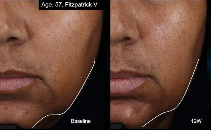 A.G.E. Interrupter Ultra Serum | Visible Lift