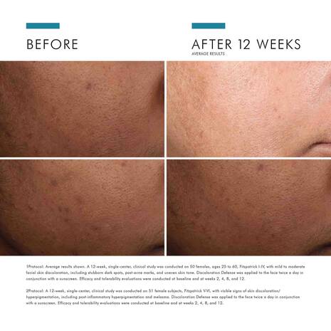 DISCOLORATION DEFENSE